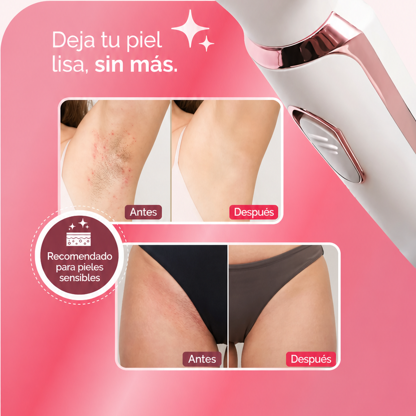 Depilador 4 en 1 DermaFlex – Elimina el vello fácil y sin dolor